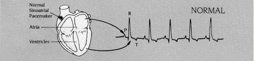 ECG_normal